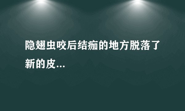 隐翅虫咬后结痂的地方脱落了新的皮...