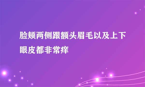 脸颊两侧跟额头眉毛以及上下眼皮都非常痒