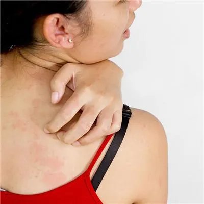 中医如何治疗过敏性紫癜