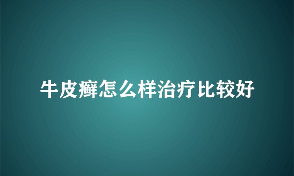 牛皮癣怎么样治疗比较好