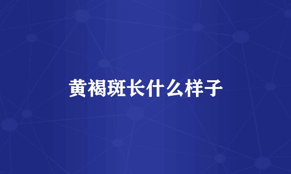 黄褐斑长什么样子