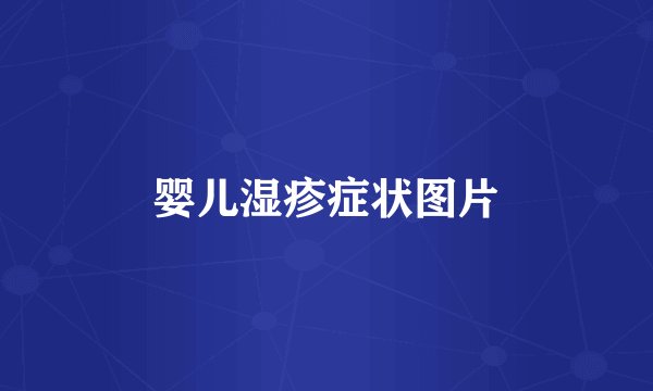 婴儿湿疹症状图片
