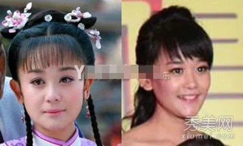 有哪些整容失败的女明星?
