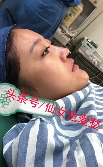 有哪些整容失败的女明星?
