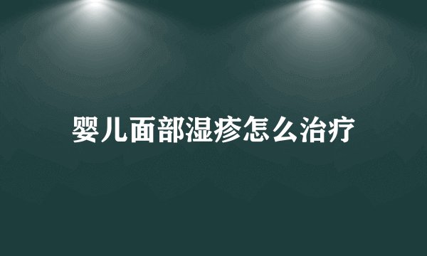 婴儿面部湿疹怎么治疗