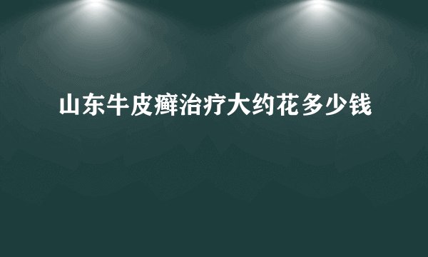 山东牛皮癣治疗大约花多少钱