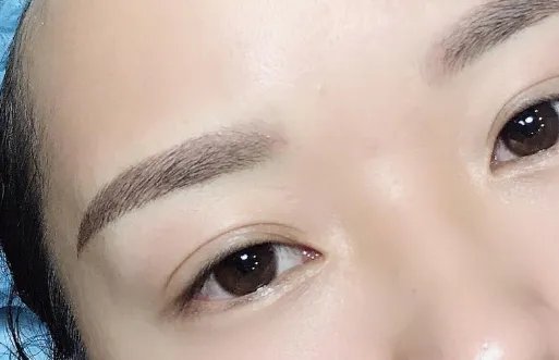 全切双眼皮哪家医院好