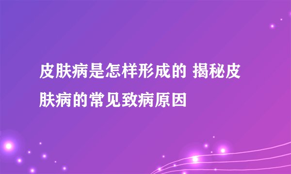 皮肤病是怎样形成的 揭秘皮肤病的常见致病原因