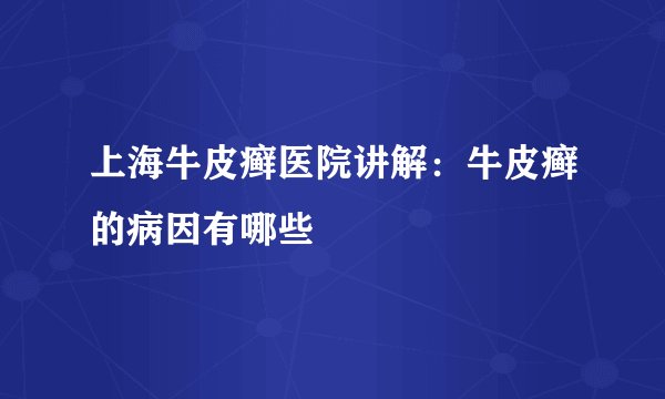 上海牛皮癣医院讲解：牛皮癣的病因有哪些