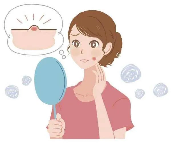 福建一男子反复挤痘出血不止引发血管瘤,有痘痘该如何正确清理?