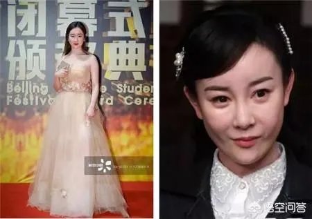 有哪些整容失败的女明星?