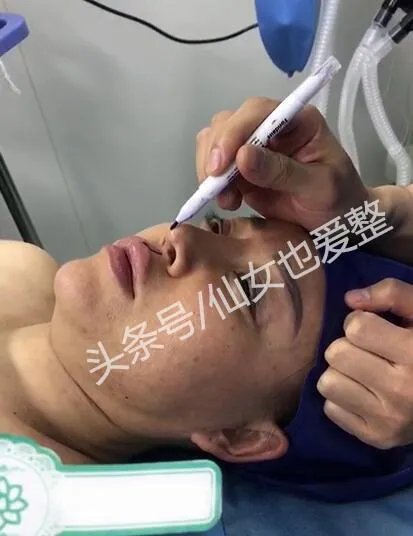 有哪些整容失败的女明星?