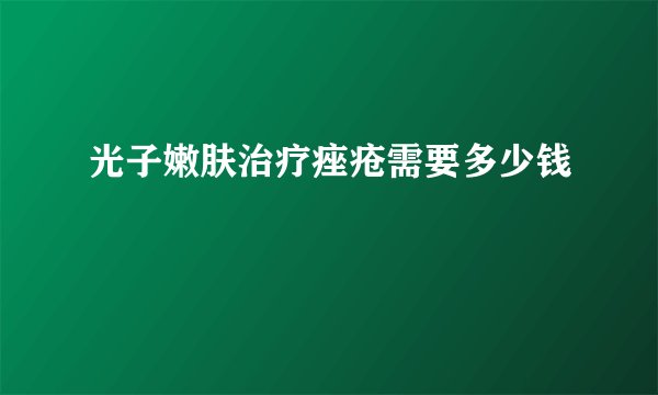 光子嫩肤治疗痤疮需要多少钱