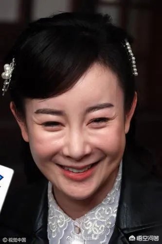 有哪些整容失败的女明星?