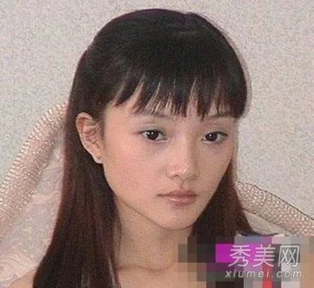 有哪些整容失败的女明星?