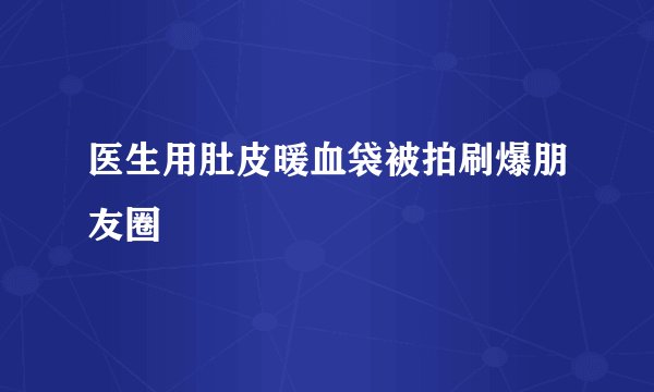 医生用肚皮暖血袋被拍刷爆朋友圈