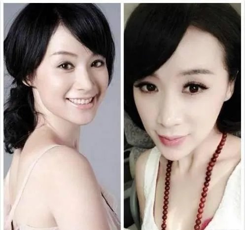 有哪些整容失败的女明星?