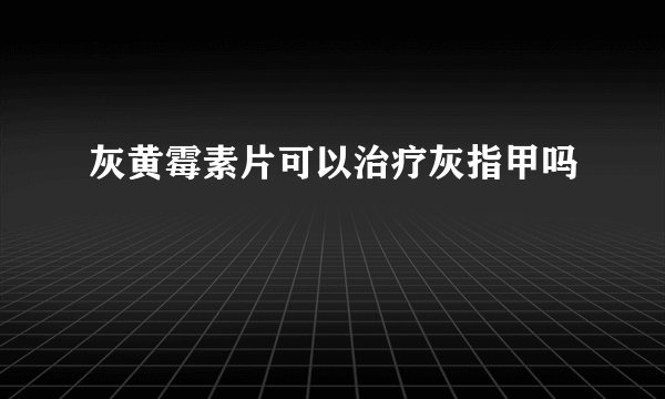 灰黄霉素片可以治疗灰指甲吗