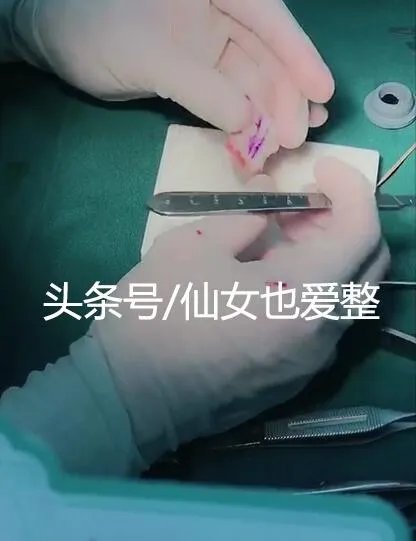 有哪些整容失败的女明星?