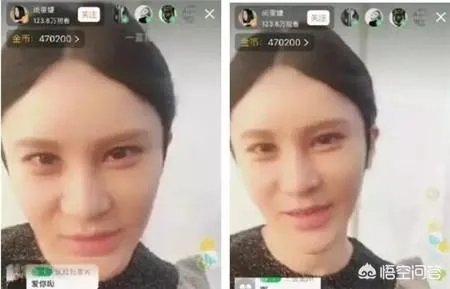 有哪些整容失败的女明星?
