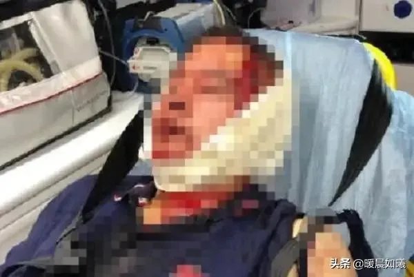 如何看待上海两名小学生打闹引发爸爸约架:一人头被敲破,警方已介入?
