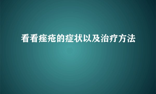看看痤疮的症状以及治疗方法