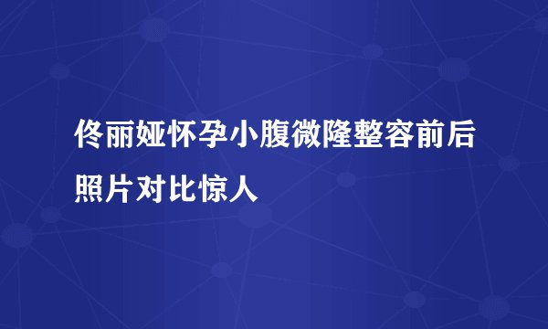佟丽娅怀孕小腹微隆整容前后照片对比惊人