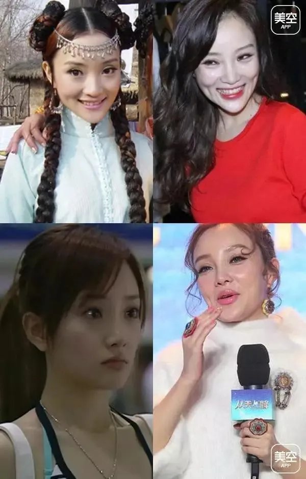 有哪些整容失败的女明星?