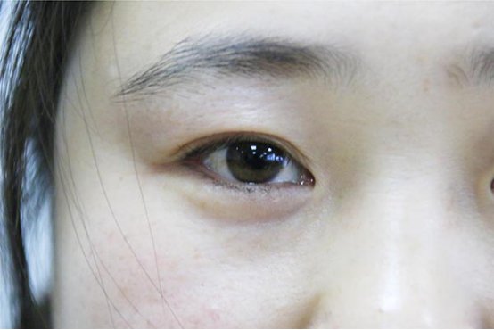 眼皮跳是什么原因