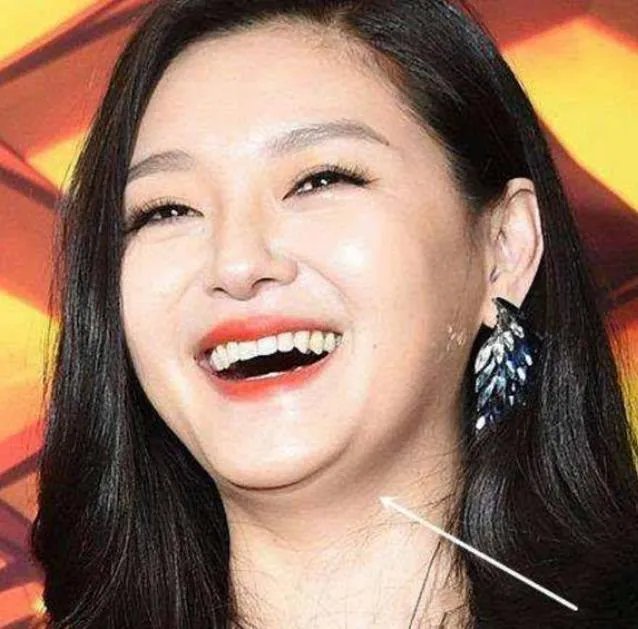 为什么说即使掉双下巴,佟丽娅也比李湘大S霍思燕漂亮?