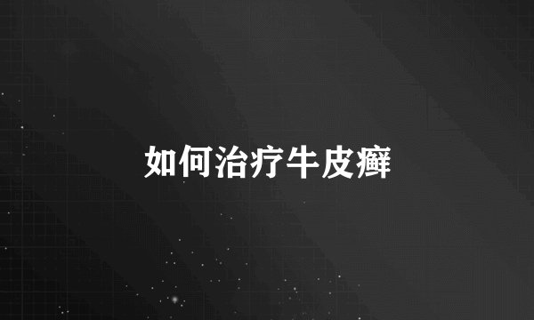 如何治疗牛皮癣