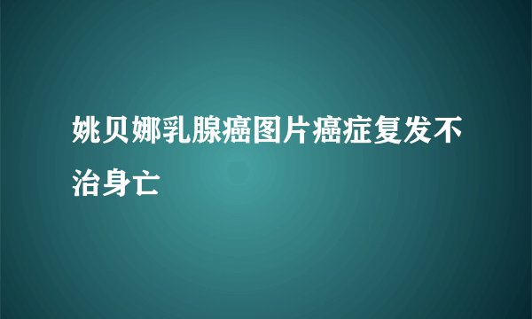 姚贝娜乳腺癌图片癌症复发不治身亡