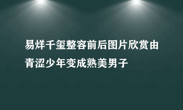 易烊千玺整容前后图片欣赏由青涩少年变成熟美男子