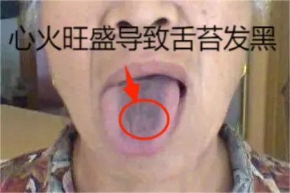 相关推荐
