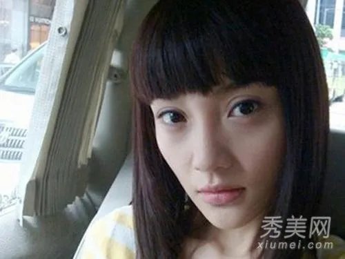 有哪些整容失败的女明星?