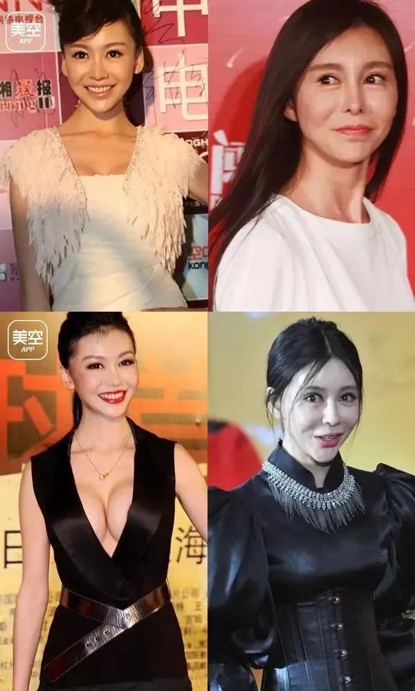 有哪些整容失败的女明星?
