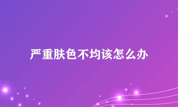 严重肤色不均该怎么办