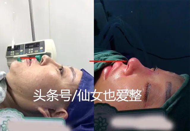 有哪些整容失败的女明星?