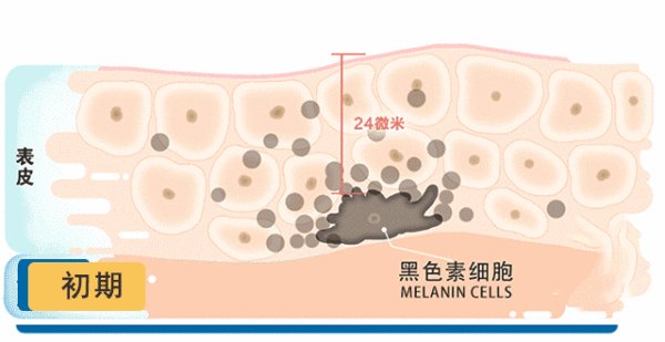 吨中药醋疗面膜加盟店在哪里