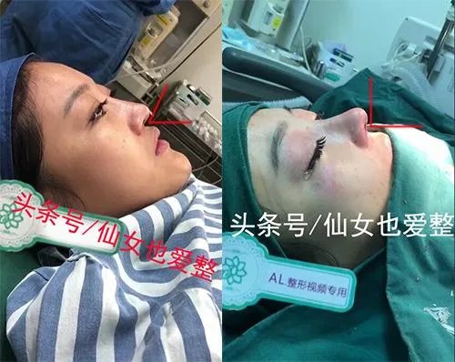 有哪些整容失败的女明星?