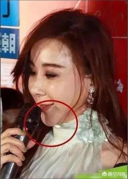 有哪些整容失败的女明星?
