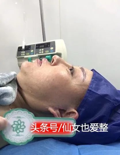 有哪些整容失败的女明星?