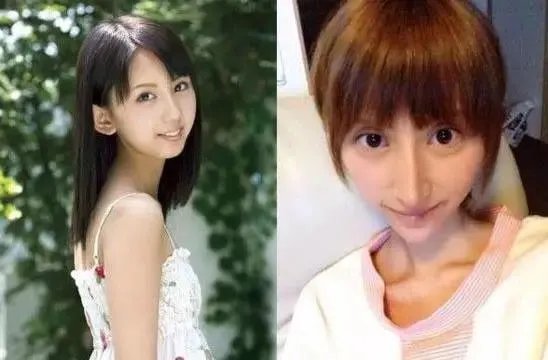 有哪些整容失败的女明星?