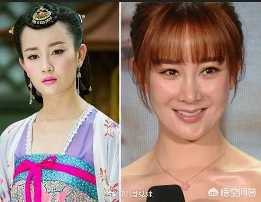 有哪些整容失败的女明星?