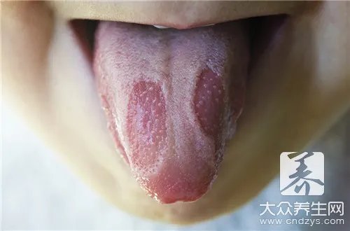 舌苔发白是啥原因
