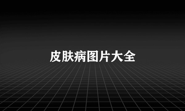 皮肤病图片大全