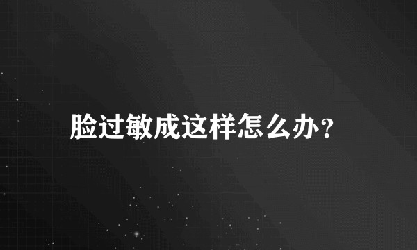 脸过敏成这样怎么办？