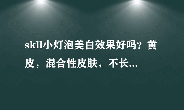 skll小灯泡美白效果好吗？黄皮，混合性皮肤，不长痘，卸妆之后T区和嘴唇周围发黄，用小灯泡可以改善吗？
